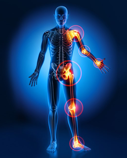 full body pain image